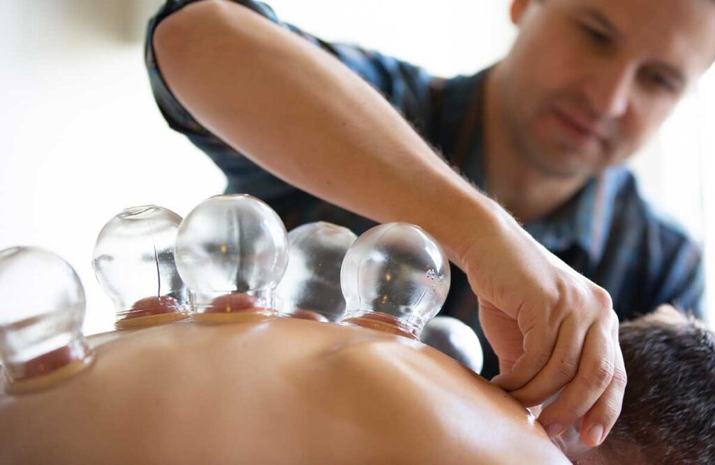 History of Cupping